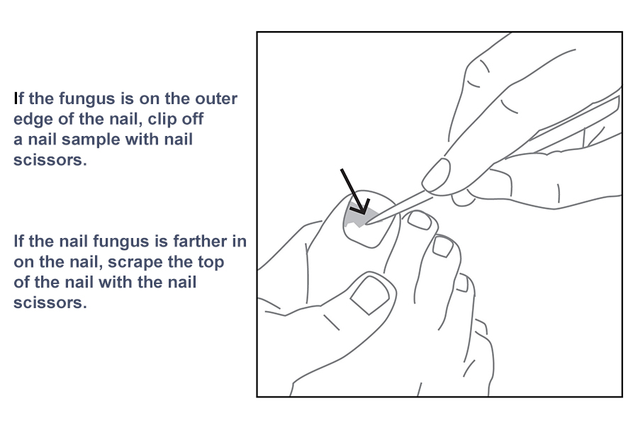 Toenail & Skin Problems | Podiatrist Enfield & South Windsor, CT —  PodiatryCare, P.C. and the Heel Pain Center