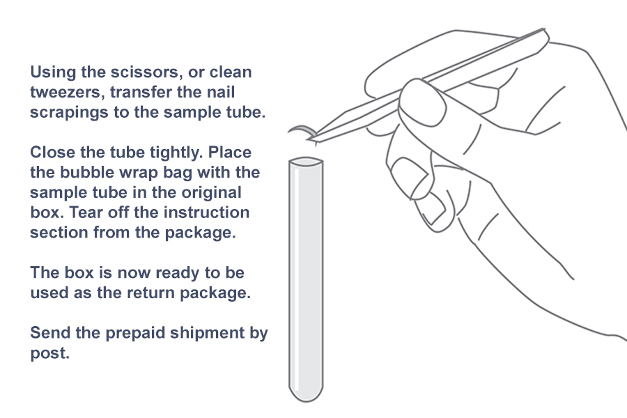 Fungal Nail Infection-5 Questions to ASK - A Step Ahead Foot and Ankle Care